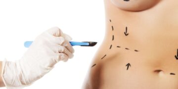 Transform Your Body and Boost Your Confidence