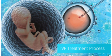 best ivf center in hyderabad